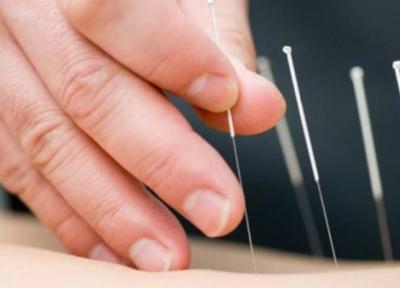 طب سوزنی چگونه باعث لاغری شکم و پهلو میشود؟